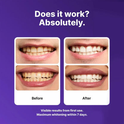 💜Purple Teeth Whitening Strips - Safe for Enamel✨🦷