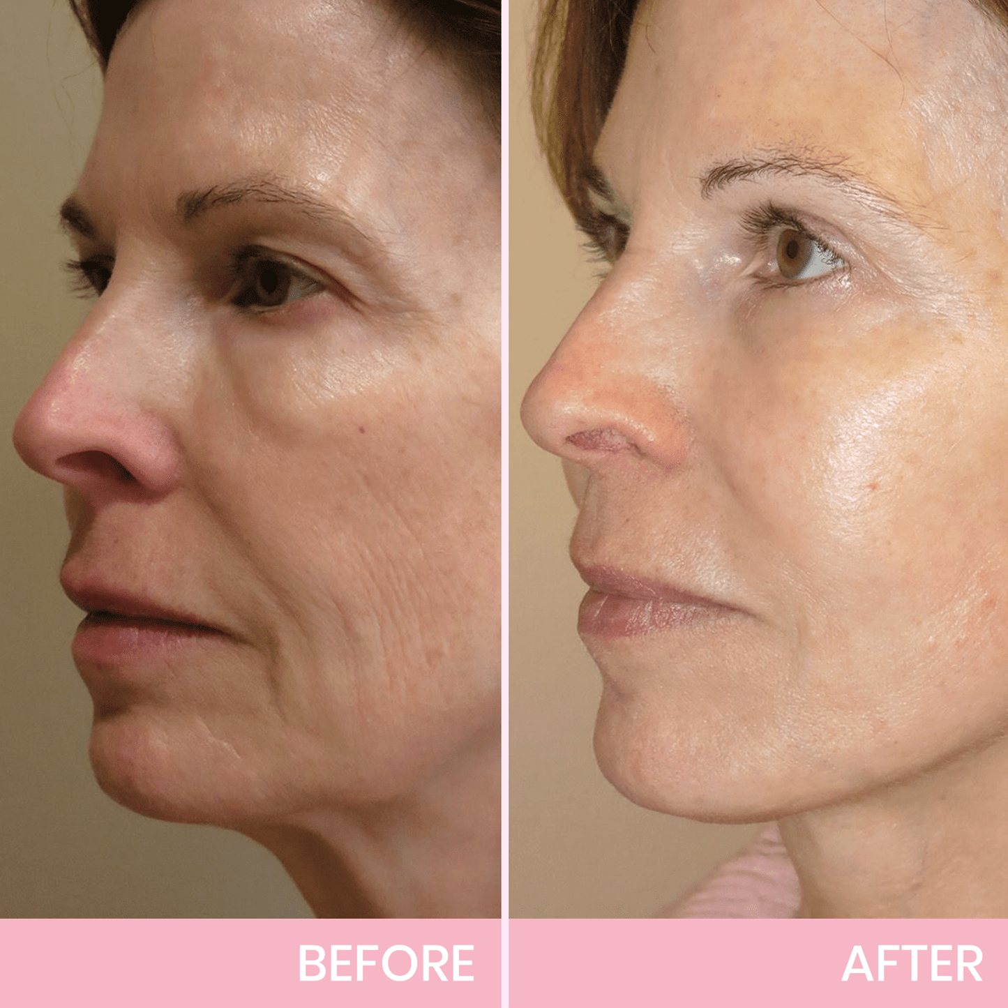 🎁Give the Gift of Beauty in 2025 with BBOJI™